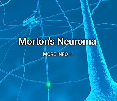 Morton's Neuroma