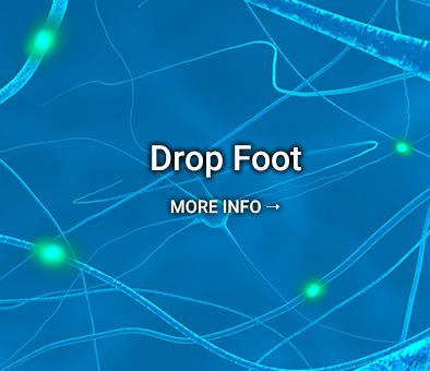 Drop Foot