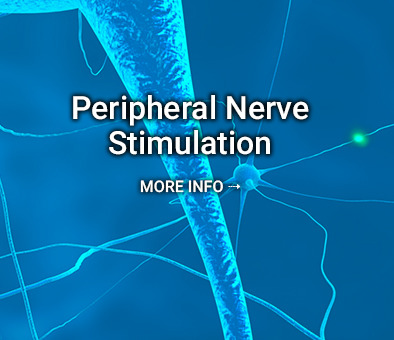 Peripheral Nerve Stimulation